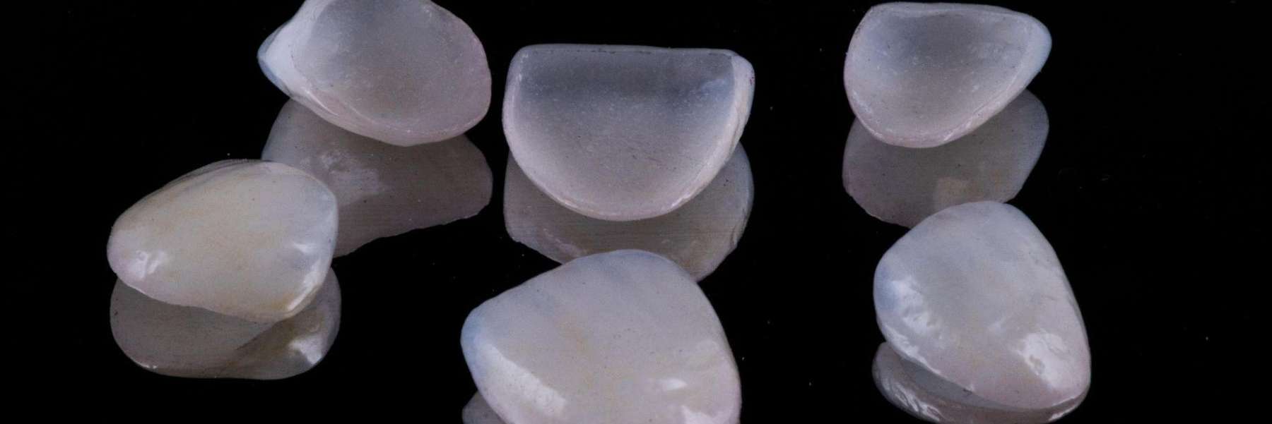 veneers near me and how veneers look