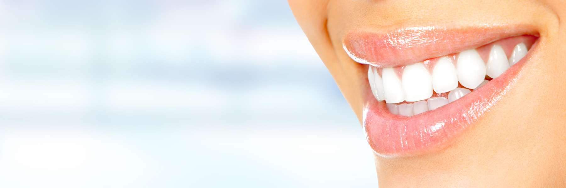 patient with porcelain veneers in mccrae