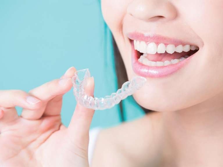 patient putting in clear aligner mccrae