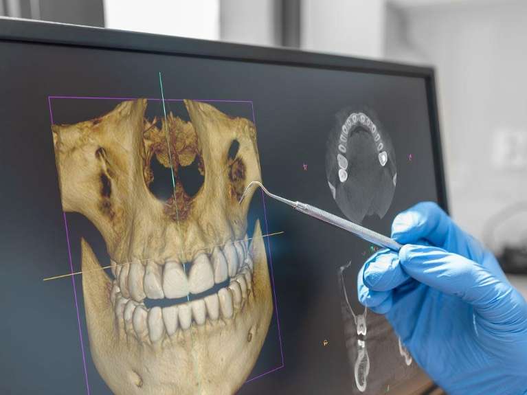 dentist in mccrae looking at patient's CBCT image