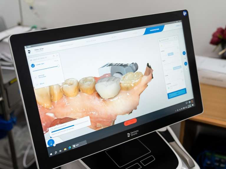 example of the results of digital impressions taken by a dentist in mccrae
